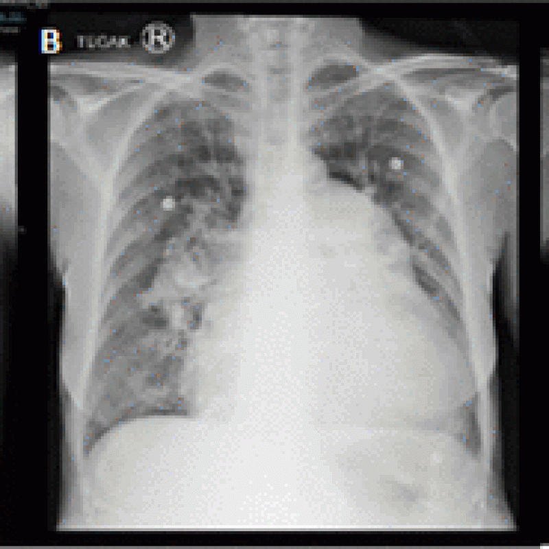 10.1177_11795484211073292-fig1