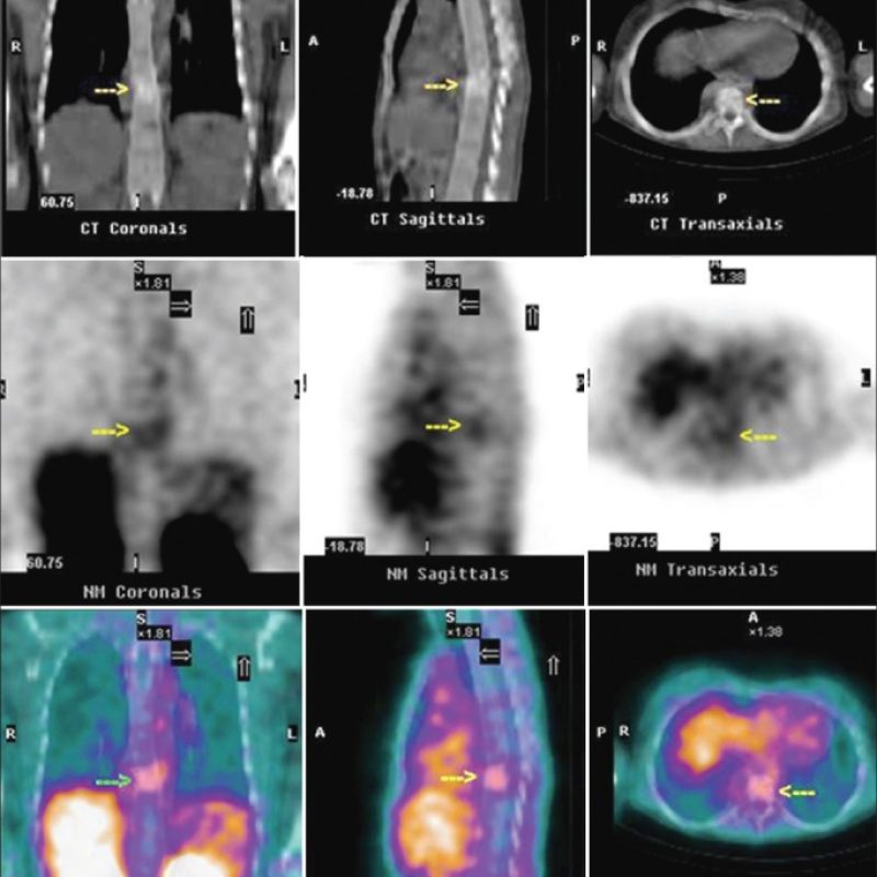 WorldJNuclMed_2019_18_1_13_250325_f1